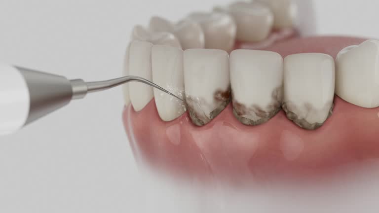Reliable Dental contractor in Lone Tree, CO by Dentist Open Now